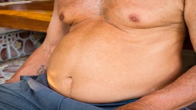 Is 48 Inch Waist Too Big? Understanding the Dangers of Abdominal Obesity